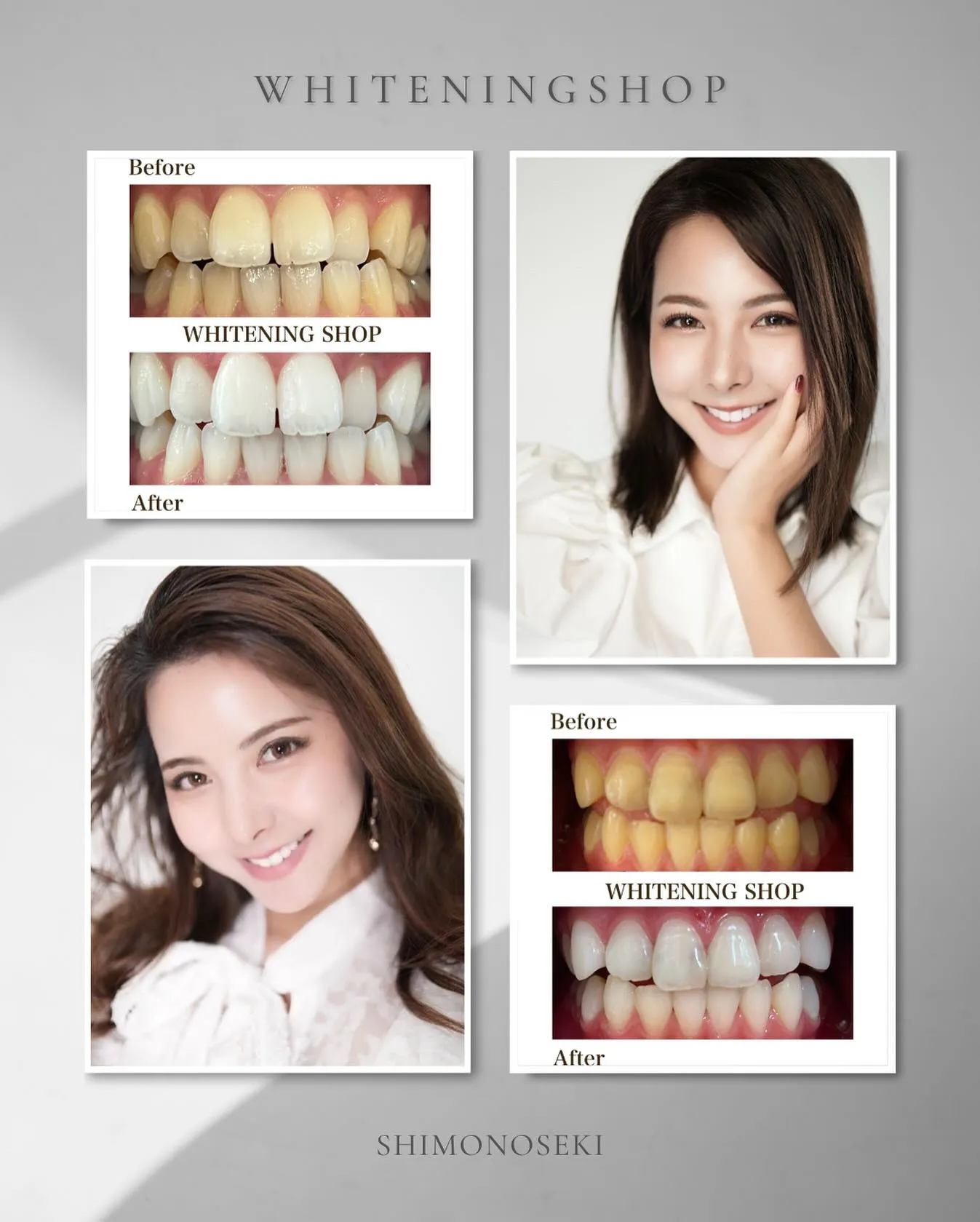 こんにちは☺️ホワイトニングショップ下関店です✨️