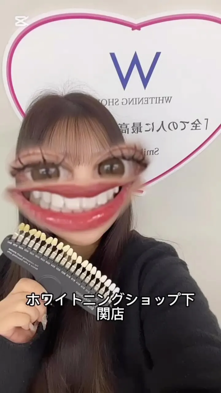 ホワイトニングのメリット❣️